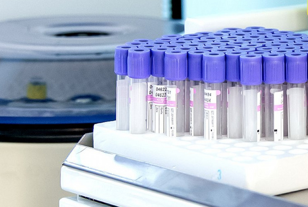 Нижегородские власти обнародовали новые данные по заболеваемости коронавирусом