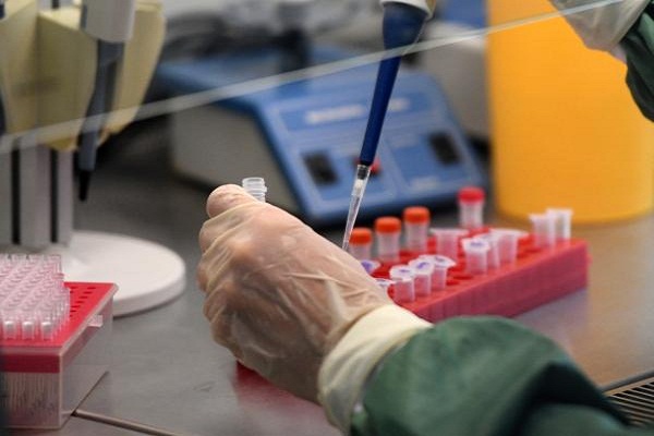 Всего 25: в Нижегородской области выявлено еще 13 случаев заражения коронавирусом